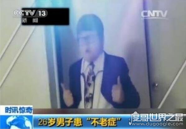 不老症真的能长生不老吗 患病“高地人症候群”(长大/衰老缓慢)